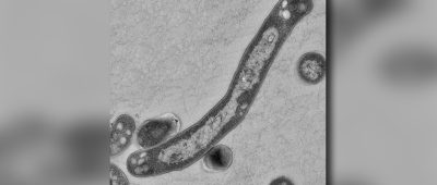 Der Tuberkulose-Erreger Mykobakterium Tuberkulosis, aufgenommen unter dem Elektronenmikroskop. Foto: Robert-Koch-Institut/Gudrun Holland/dpa-Bildfunk.