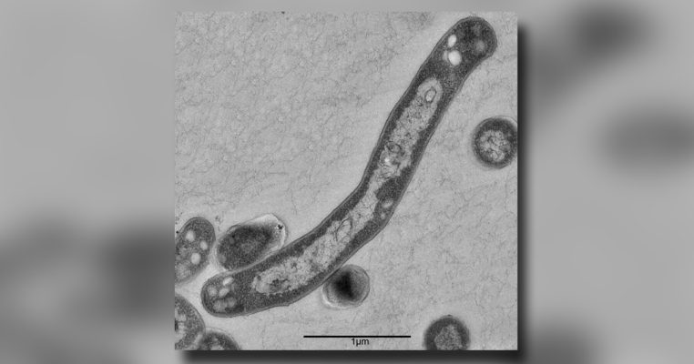 Der Tuberkulose-Erreger Mykobakterium Tuberkulosis, aufgenommen unter dem Elektronenmikroskop. Foto: Robert-Koch-Institut/Gudrun Holland/dpa-Bildfunk.