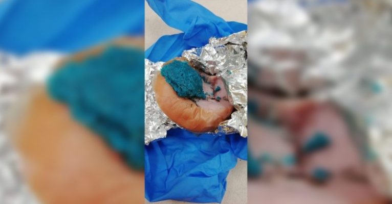 In Eppelborn-Dirmingen wurden Giftköder sowie mit Glasscherben präparierte Fleischstücke gefunden. Symbolfoto: Polizei