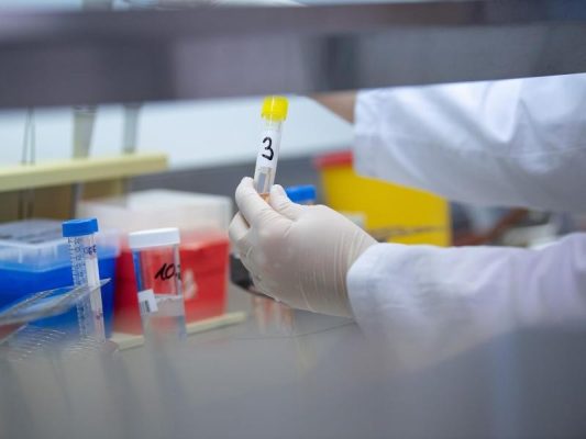 Eine Ärztin zeigt in einem Labor einen Test für das Coronavirus. Foto: Sebastian Gollnow/dpa/Symbolbild
