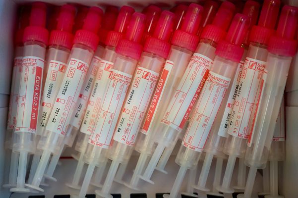 Blutproben von 2.300 Saarländern sollen Aufschluss über die Dunkelziffer von Corona-Infektionen geben. Symbolfoto: Peter Kneffel/dpa-Bildfunk