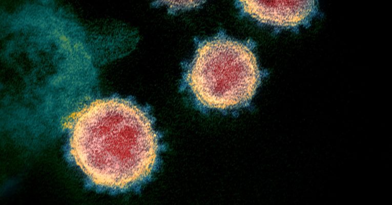 Ein Transmissionselektronenmikroskop macht das Coronavirus sichtbar. Foto: National Institute of Allergy and Infectious Diseases/CC BY 2.0