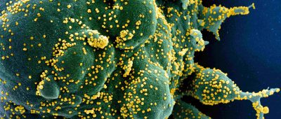 Die Zahl der Corona-Infektionen im Saarland ist gestiegen. Foto: Niaid/Europa Press/dpa-Bildfunk