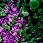Die Zahl der Corona-Infektionen im Saarland ist gestiegen. Unser Foto aus einem Mikroskop zeigt eine mit dem Virus (lila) infizierte Zelle (grün).  Foto: Niaid/Europa Press/dpa-Bildfunk