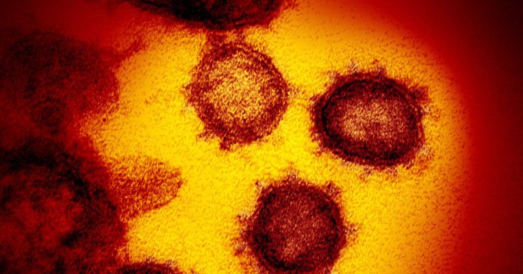 Die Zahl der Corona-Infektionen im Saarland ist gestiegen. Foto: NIAID-RML/AP/dpa-Bildfunk